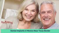 Implantes dentales en México cerca de la frontera con Texas: una opción conveniente